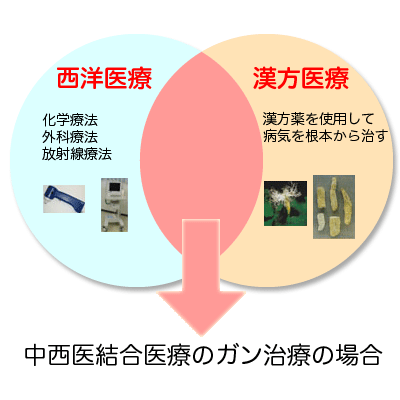 中西医統合医療のがん治療の場合