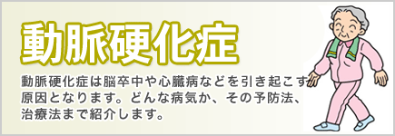 動脈硬化症 - 動脈硬化症は脳卒中や心臓病などを引き起こす原因となります。どんな病気か、その予防方法、治療法まで紹介します。