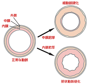 死亡数グラフ