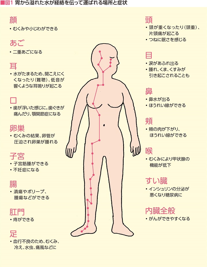 図1　胃から溢れた水が経絡を伝って運ばれる場所と症状