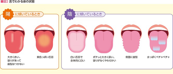 図2　舌でわかる体の状態