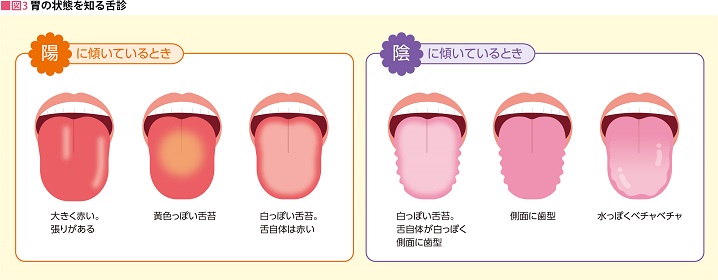 胃の状態を知る舌診